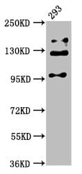 Polyclonal Rabbit anti-Human RAB3GAP2 / p150 Antibody (IHC, WB)