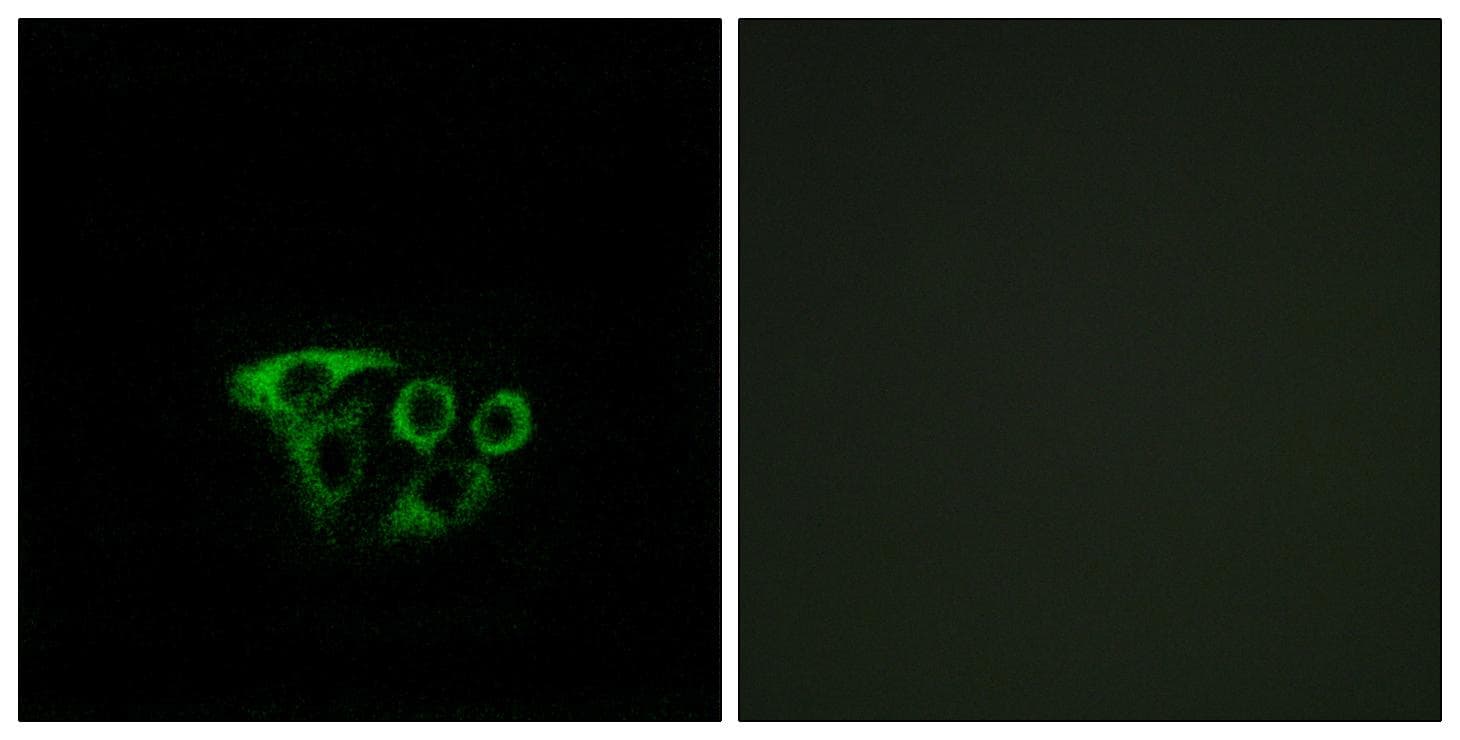 Polyclonal Rabbit anti-Human ATP5L2 Antibody (IF, WB)