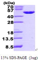 Human PA2G4 / EBP1 Protein (Recombinant His)