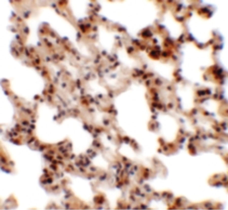 Polyclonal Rabbit anti-Human Coronin 7 / CORO7 Antibody (IHC, IF, WB)