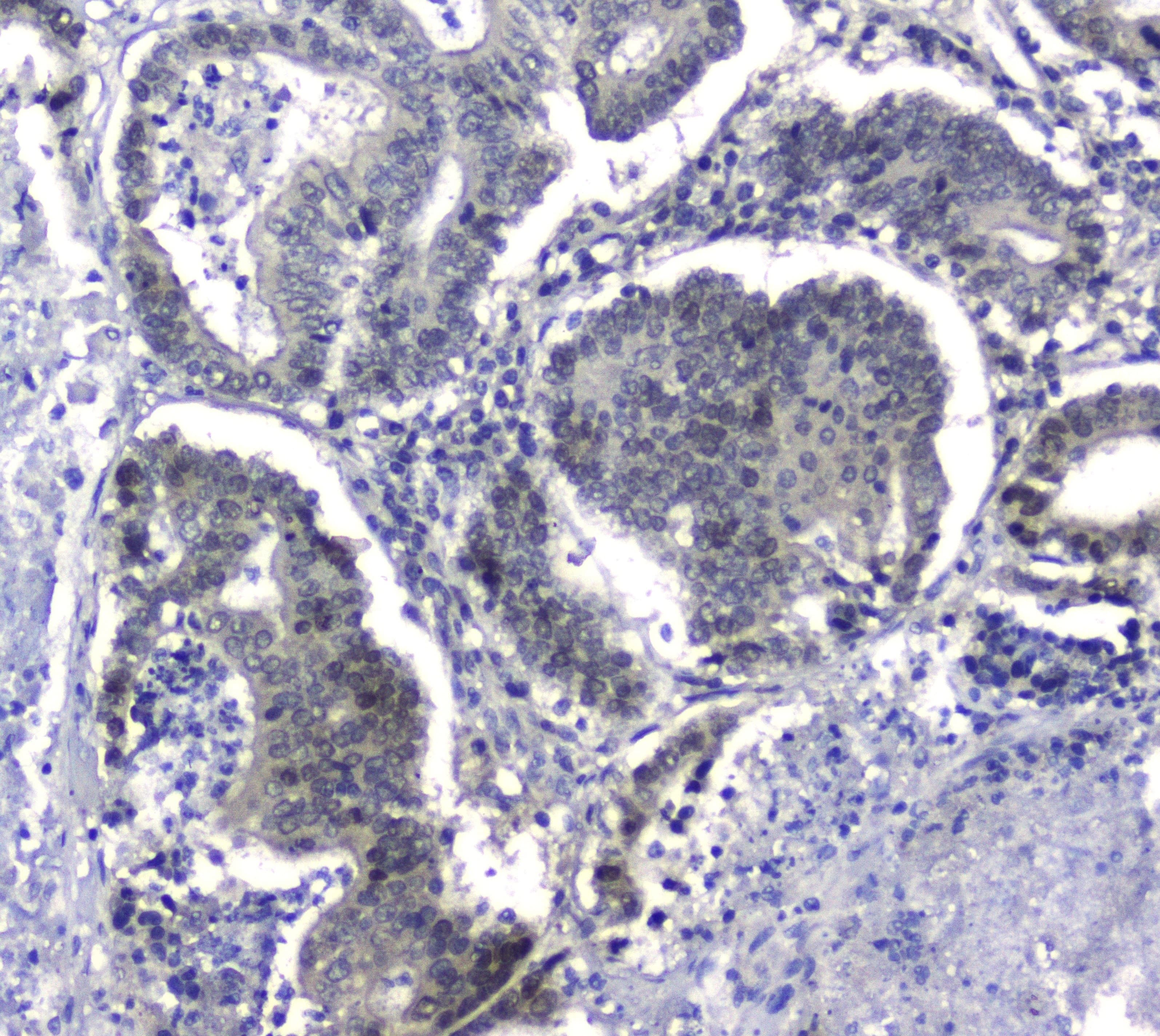 Polyclonal Rabbit anti-Human HSPH1 / HSP105 Antibody (IHC, WB)