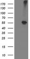 ADH2 / ADH1B Antibody (clone OTI1H7)