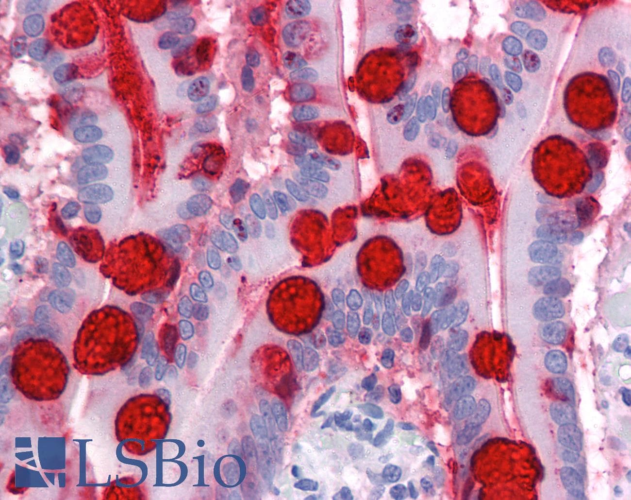 PathPlus™ Monoclonal Mouse anti-Human TFF3 / Trefoil Factor 3 Antibody (clone 3D9, IHC, WB)