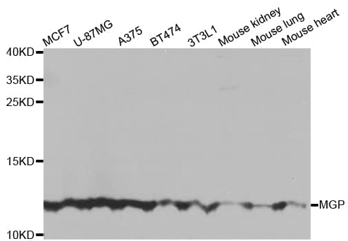 IHC-plus™ MGP / Matrix Gla-Protein Antibody