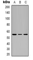 TP53 / p53 Antibody (N-Terminus)