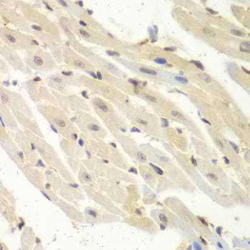 Polyclonal Rabbit anti-Human PSME1 Antibody (IHC, IF, WB)