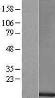 BHLHA19 / TAL2 Protein (Over-Expression Lysate Myc-DDK (Flag))