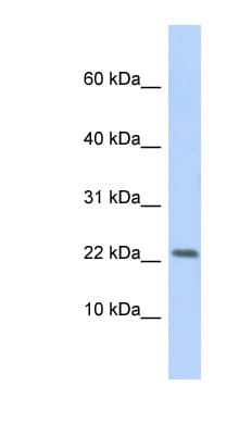 P2RX7 / P2X7 Antibody (aa71-120)