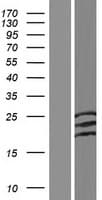 ACP2 / Acid Phosphatase 2 Protein (Over-Expression Lysate Myc-DDK (Flag))