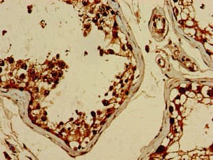 BRIP1 / BACH1 Antibody