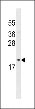 Polyclonal Rabbit anti-Human ADI1 / ARD Antibody (aa88-116, WB)