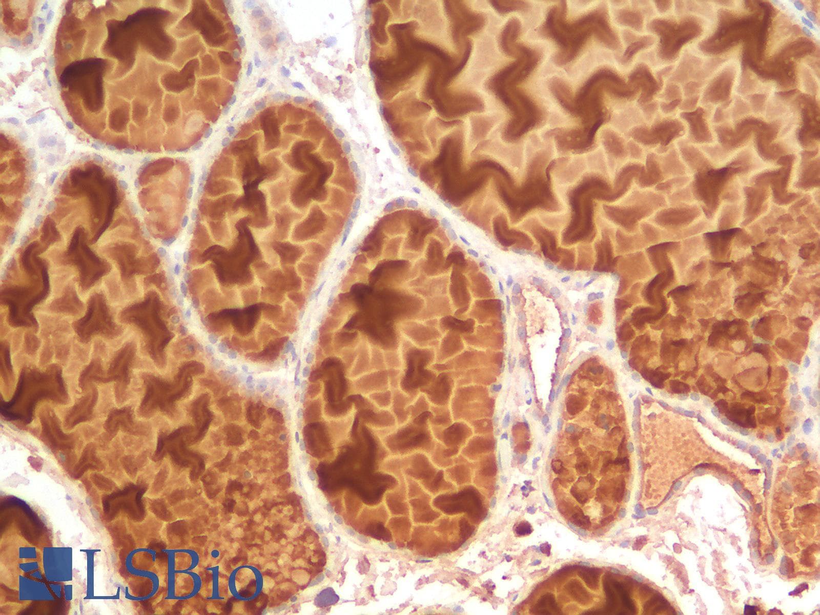 IHC-plus™ Recombinant Monoclonal Mouse anti-Human EPCAM Antibody (clone rEGP40/1110, aa 280-350, IHC)