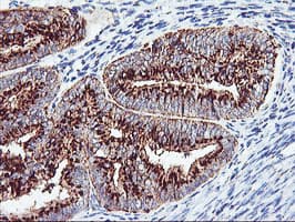 GOLM1 / GP73 / GOLPH2 Antibody (clone OTI2D6)