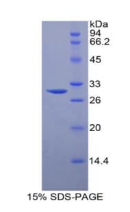 Human SPHK / SPHK1 Protein (Recombinant His)