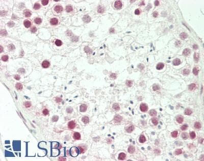 IHC-plus™ Polyclonal Rabbit anti-Human NCAPH / CAP-H Antibody (aa354-382, IHC, WB)