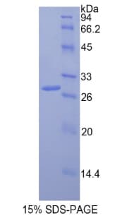 Rat MMRN1 Protein (Recombinant His)