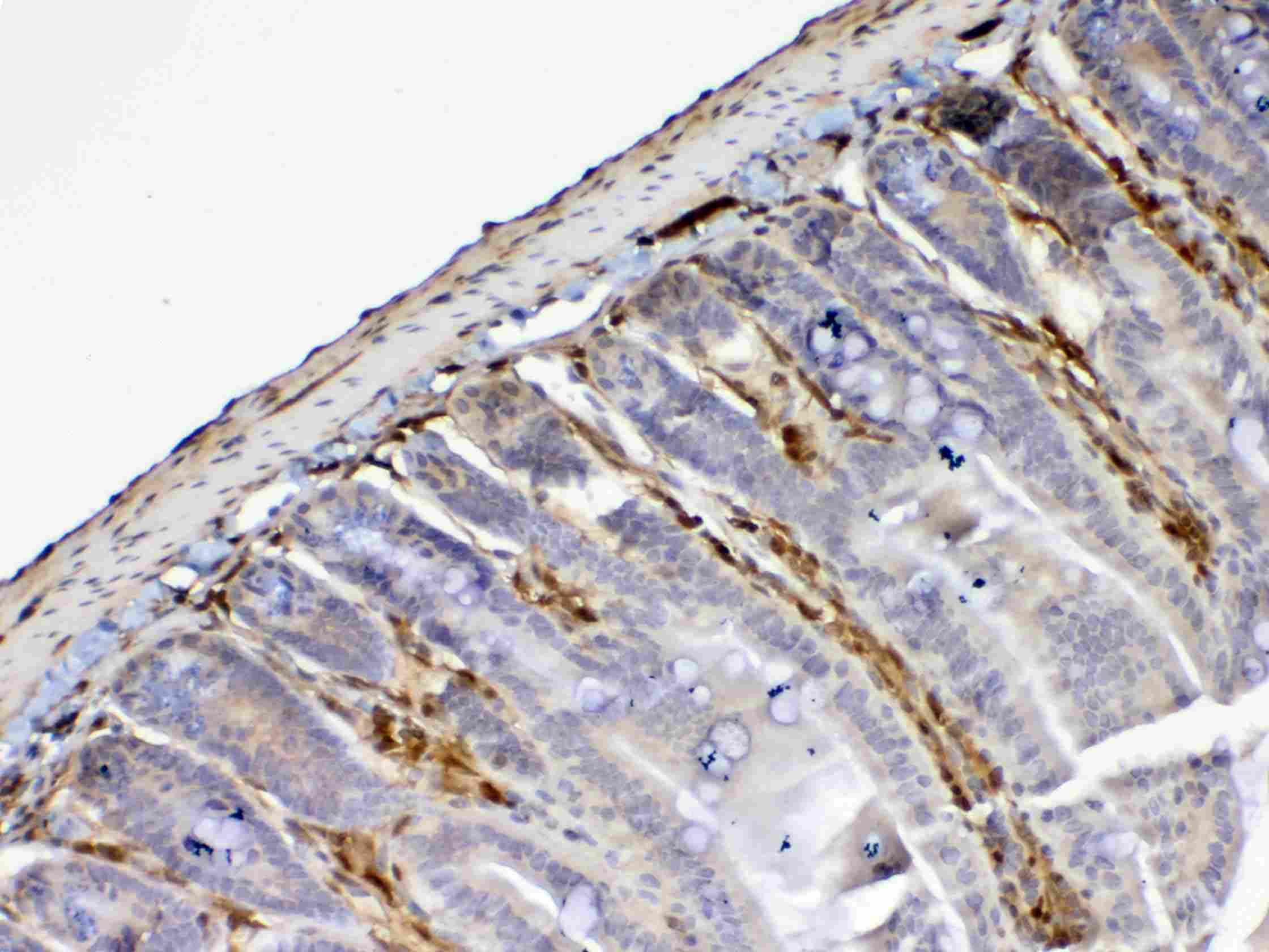 LGALS1 / Galectin 1 Antibody