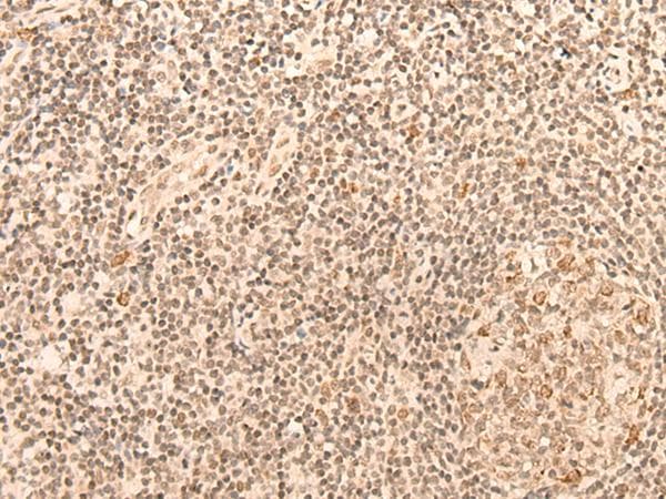 CCNE1 / Cyclin E1 Antibody