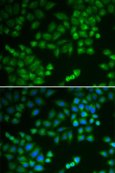 RPL5 / Ribosomal Protein L5 Antibody