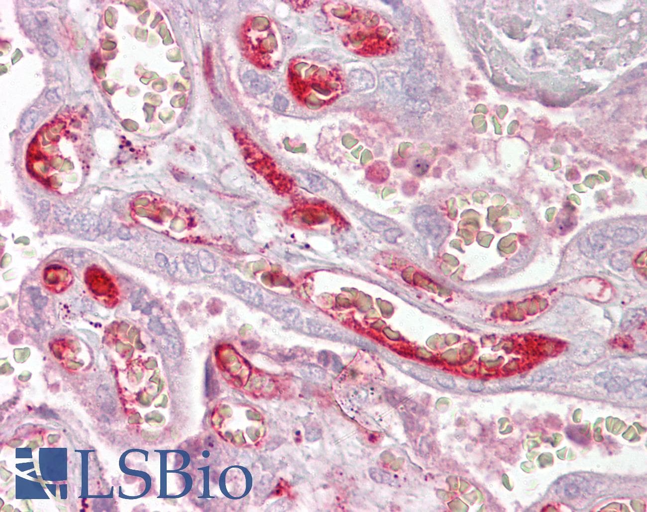 Polyclonal Rabbit anti-Human PPP2R3A / PR130 Antibody (aa179-228, IHC, WB)