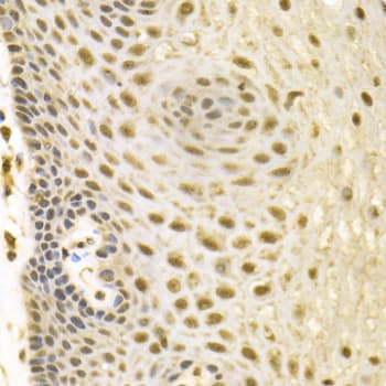 BAG1 / BAG-1 Antibody