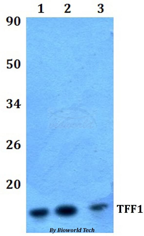 Polyclonal Rabbit anti-Human TFF1 / pS2 Antibody (WB)