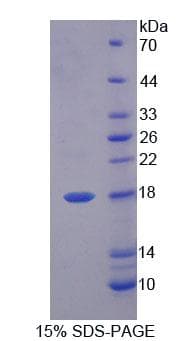 Pig I-BABP / FABP6 Protein (Recombinant His-T7, N-terminus)