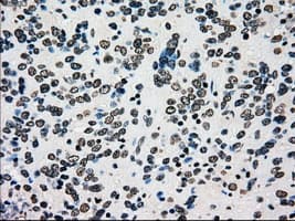 Monoclonal Mouse anti-Human PMEL / SILV / gp100 Antibody (clone OTI10E5, IHC, IF, WB)
