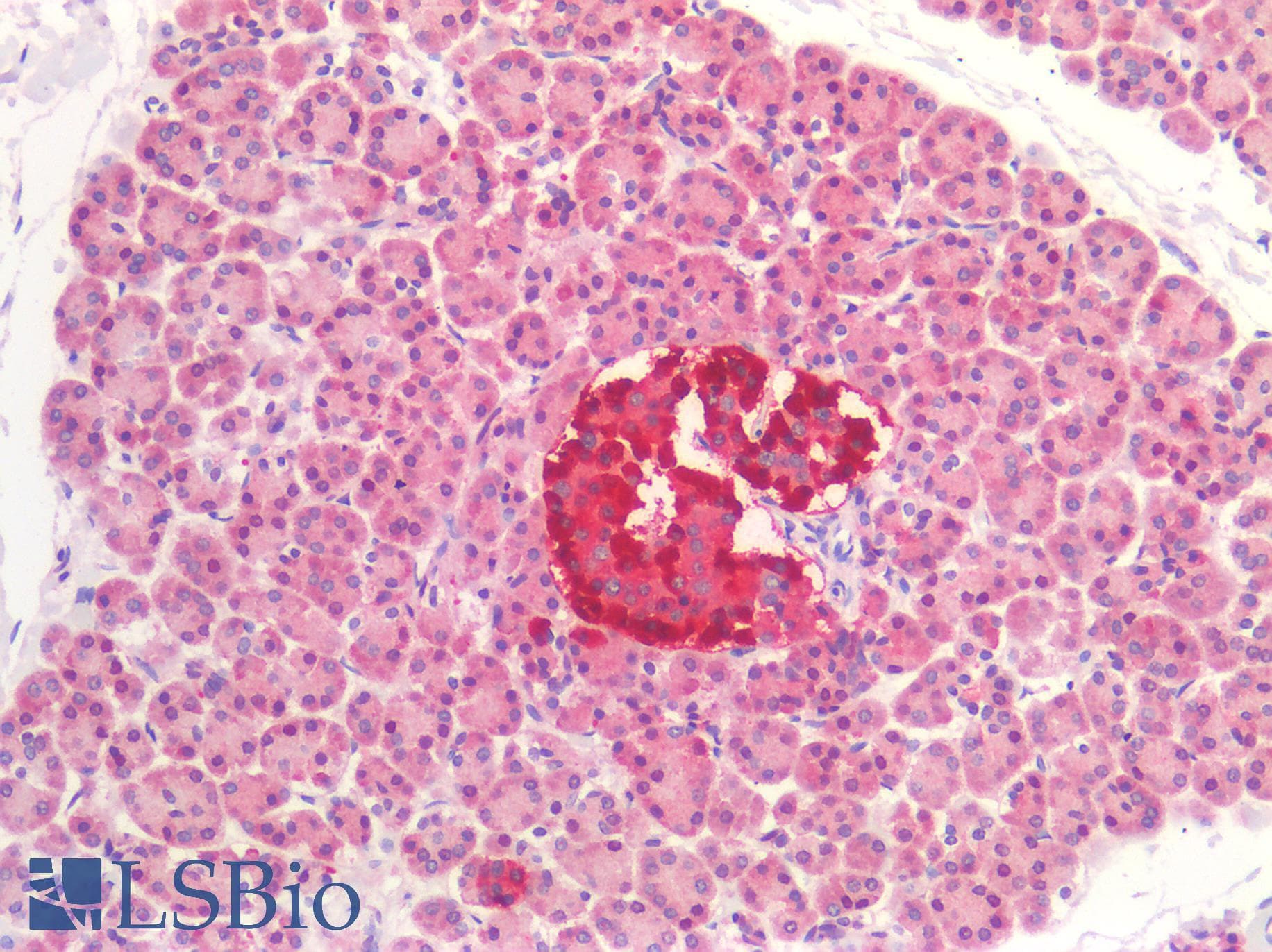 IHC-plus™ GAD65 Antibody