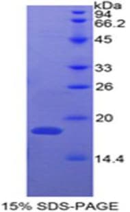 Bovine Ribonuclease A / RNASE1 Protein (Recombinant His, N-Terminal)