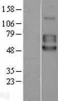 Human TPBG / 5T4 Protein (Over-Expression Lysate Myc-DDK (Flag))