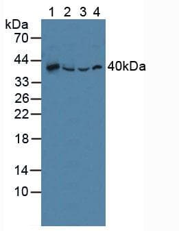 SQSTM1 Antibody (aa136-400, APC)