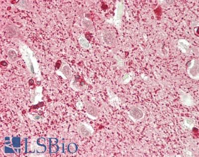 IHC-plus™ ROBO1 Antibody (aa1601-1651)
