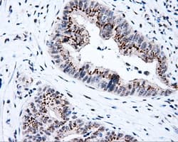 TLDC1 / KIAA1609 Antibody (clone OTI13H6)