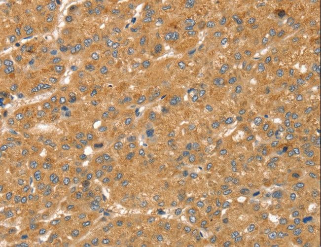 SNX2 Antibody