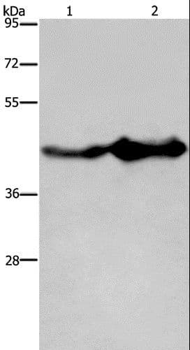GLUL / Glutamine Synthetase Antibody