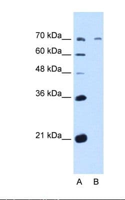 Polyclonal Rabbit anti-Human GALNT6 Antibody (aa61-110, IHC, WB)