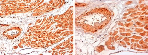 SLC2A4 / GLUT-4 Antibody