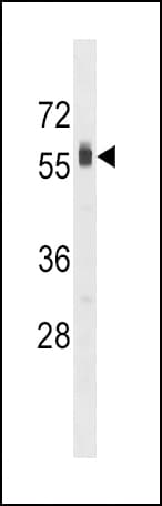 SPHK2 Antibody (aa590-620)