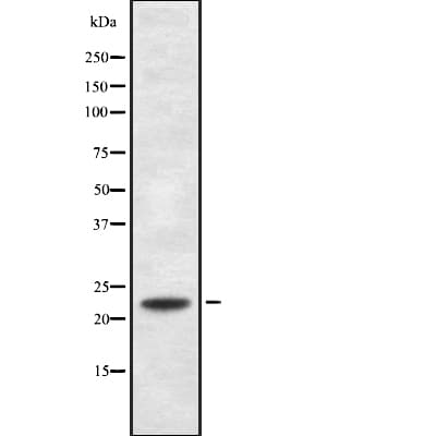 Polyclonal Rabbit anti-Human RANBP1 Antibody (WB)