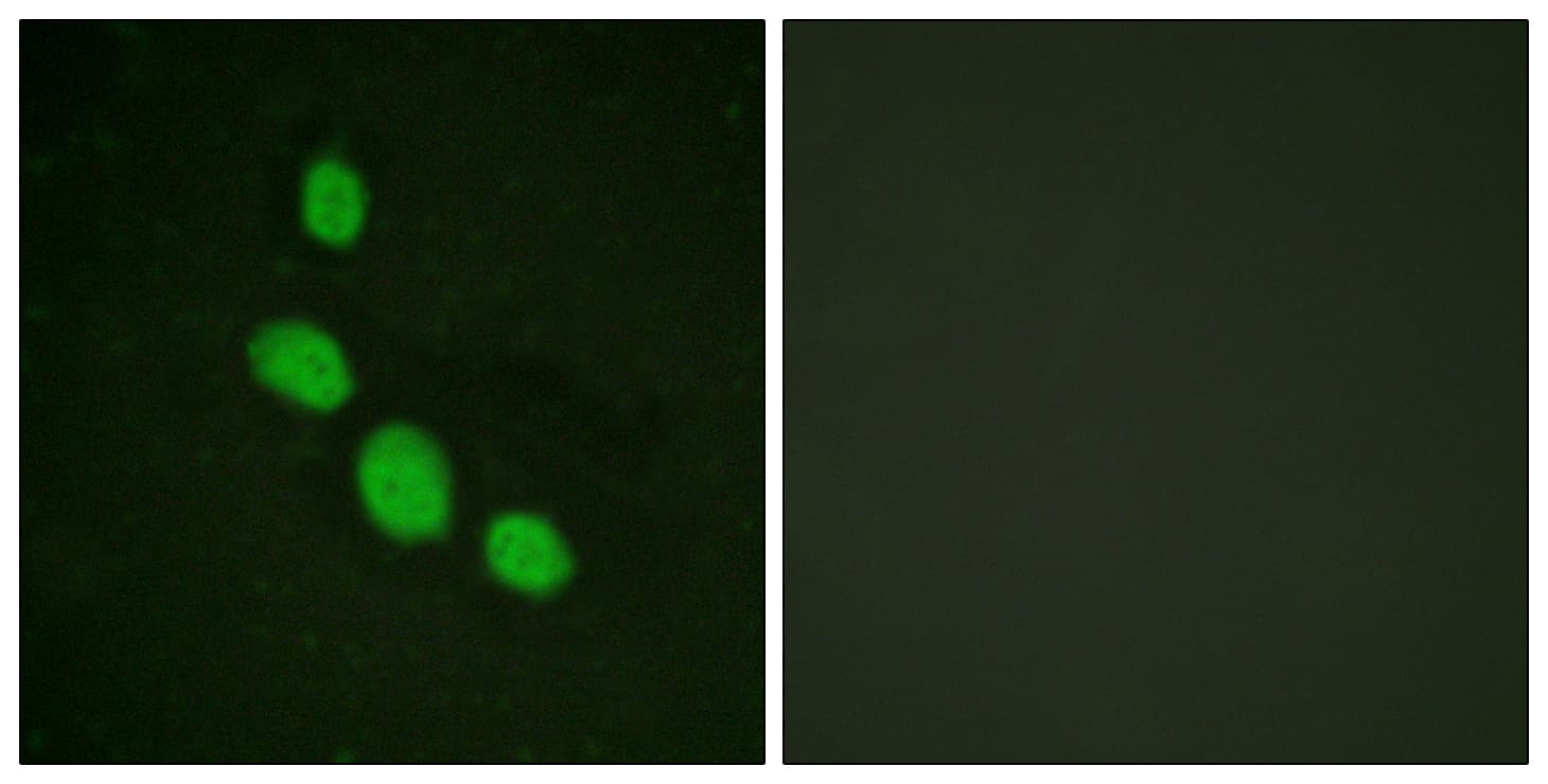Polyclonal Rabbit anti-Human C/EBP Epsilon / CEBPE Antibody (aa40-89, IHC, IF, WB)