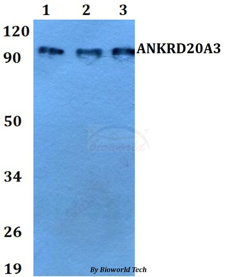 Polyclonal Rabbit anti-Human ANKRD20A3 Antibody (IHC, WB)