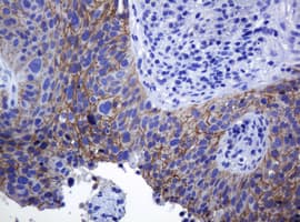 CDH1 / E Cadherin Antibody (clone OTI4F1)