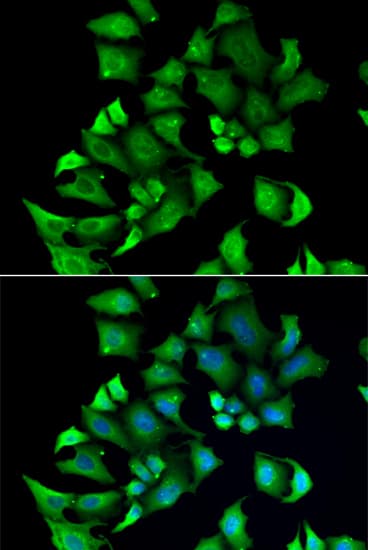 ENTPD2 Antibody