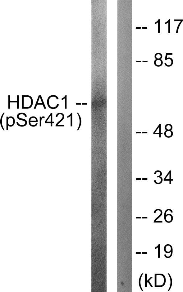 HDAC1 Antibody (phospho-Ser421)
