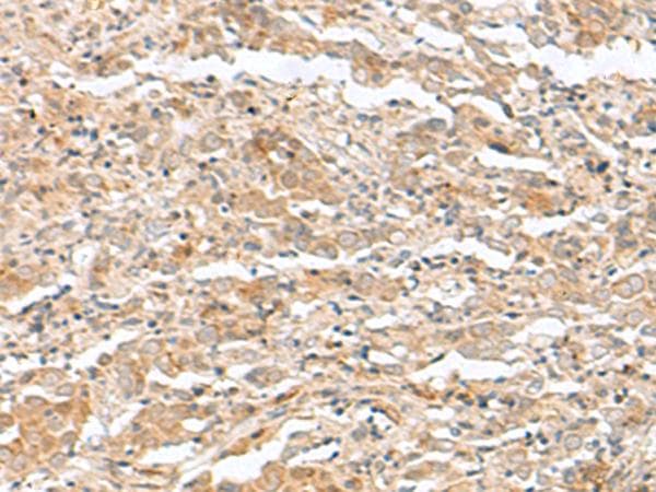 TTC12 Antibody