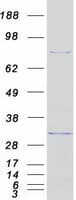 Human DDX50 Protein (Recombinant Myc-DDK (Flag))