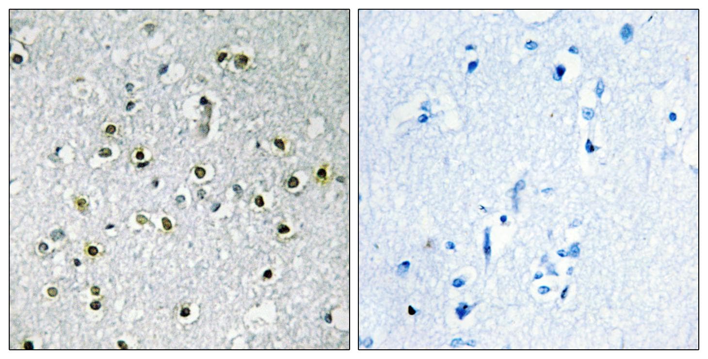 Polyclonal Rabbit anti-Human TFE3 Antibody (IHC, WB)