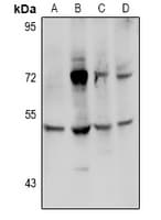 TGM3 / Transglutaminase 3 Antibody