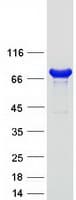 Human CARS1 / CARS Protein (Recombinant Myc-DDK (Flag))
